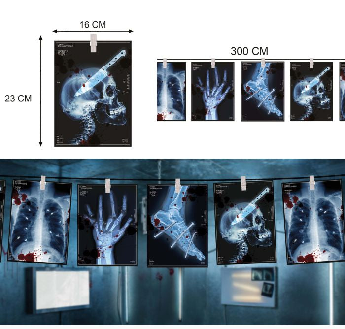 X-ray themed wall art posters showing medical imagery such as a skull with a syringe, a hand, and chest X-rays, displayed hanging on a wall. The image includes dimension callouts (16 CM, 23 CM, 300 CM) 