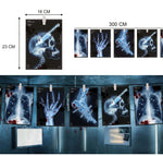 X-ray themed wall art posters showing medical imagery such as a skull with a syringe, a hand, and chest X-rays, displayed hanging on a wall. The image includes dimension callouts (16 CM, 23 CM, 300 CM) 